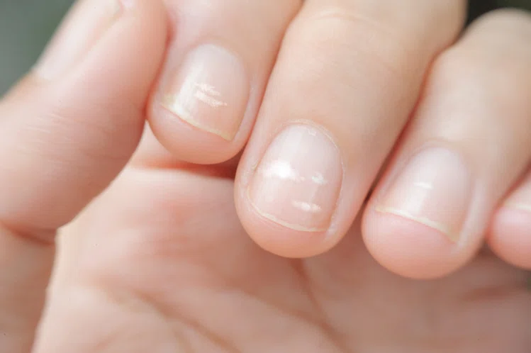 Zdjęcie O czym świadczą białe plamki na paznokciach? Sprawdź, czy sama ich nie masz! #2