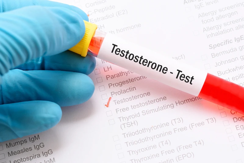 Jakie są objawy niedoboru TESTOSTERONU?