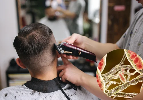 Epidemia zakaźnego grzyba w salonach fryzjerskich! Lekarze biją na alarm