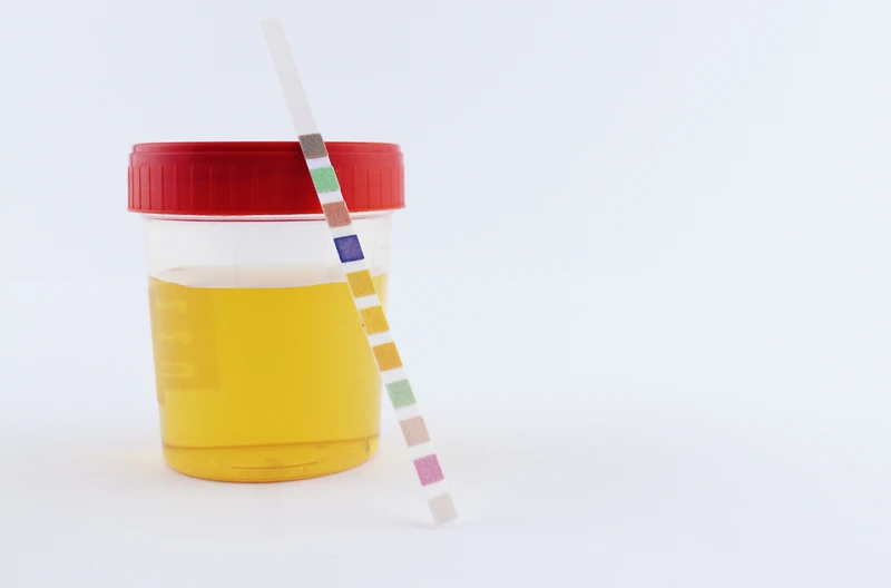 Domowy test z apteki na badanie moczu: Co wykryje? Kto powinien zrobić?