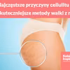 Najczęstsze przyczyny cellulitu i najskuteczniejsze metody walki z nim!
