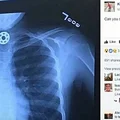 Pilnuj dziecka! Fidget spinner to niebezpieczna zabawka i narzędzie szatana!