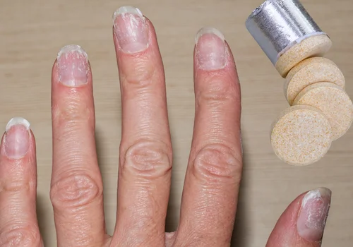 Wapno musujące na alergię jako ratunek dla cienkich i kruchych paznokci!