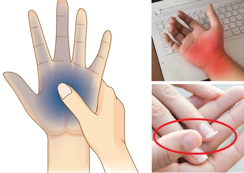 Obserwuj zdrowie swoich dłoni! Oto 7 rzeczy, które możesz z nich wyczytać