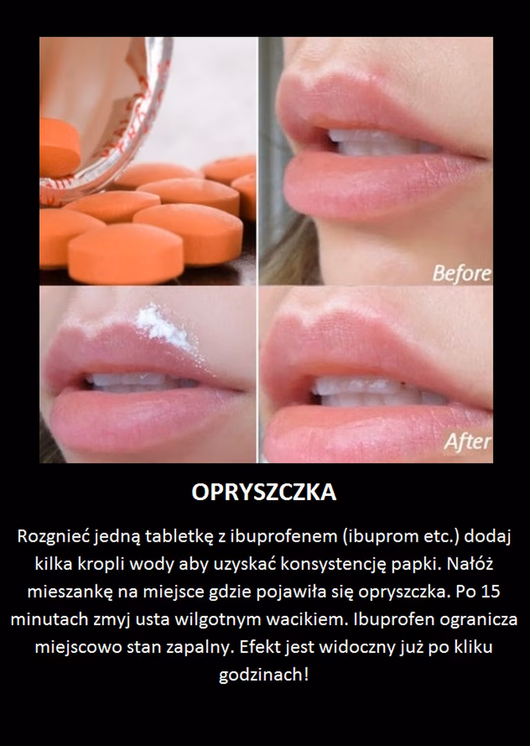 Sposób na opryszczkę, którego nie znasz!