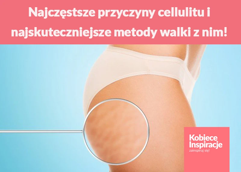 Najczęstsze przyczyny cellulitu i najskuteczniejsze metody walki z nim!