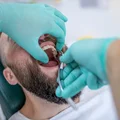 Absurdalne ceny u dentystów! Dlaczego jest tak drogo?