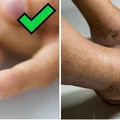 Domowy test na poziom cukru we krwi - kup w aptece. Zadbaj o zdrowie
