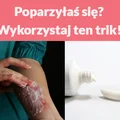 Poparzyłaś się? Wykorzystaj ten trik!