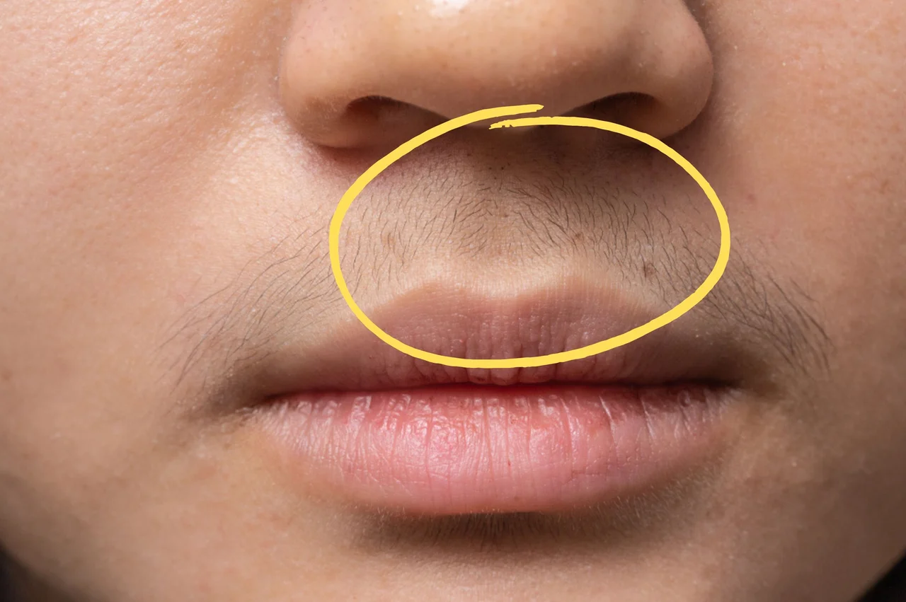 Co może oznaczać wąsik nad wargą? Miej tego świadomość
