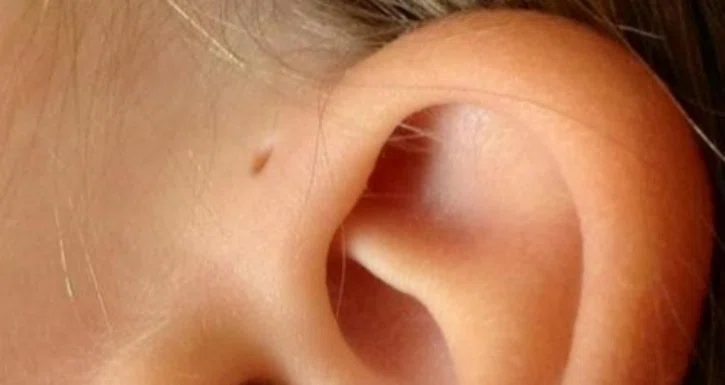 Zdjęcie Znasz kogoś, kto ma taką dziurkę na uchu? Zobacz,co ona oznacza! #1