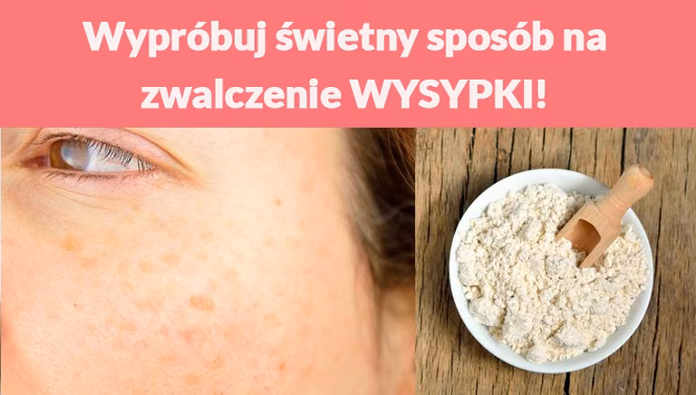 Wypróbuj świetny sposób na zwalczenie WYSYPKI!