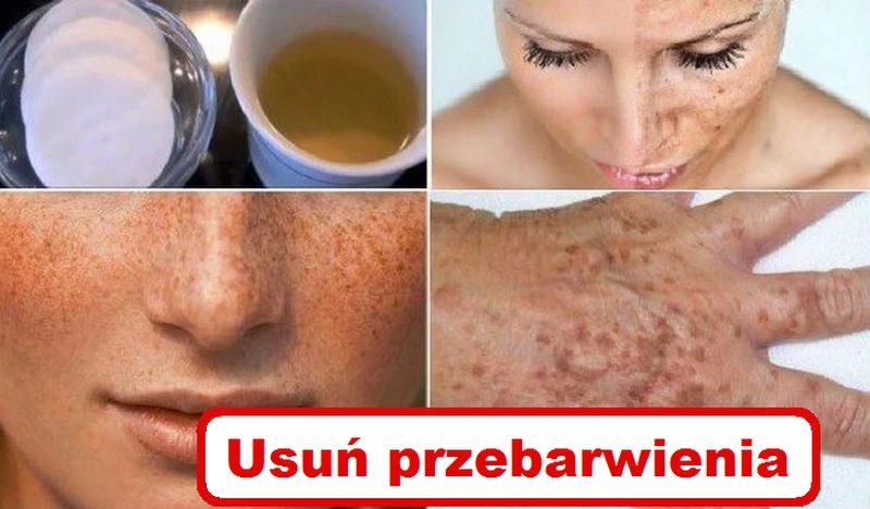 Sprawdź najlepsze domowe MASECZKI na PRZEBARWIENIA