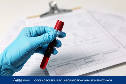Morfologia krwi – w jakim celu warto wykonać to badanie?
