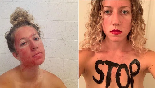 Instagramerka z twarzą wysmarowaną krwią z miesiączki. To walka o prawa kobiet?