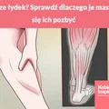 Skurcze łydek? Sprawdź dlaczego je masz i jak się ich pozbyć