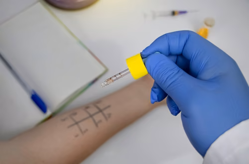 Co warto wiedzieć przed wizytą u alergologa?  Jak wyjść z gabinetu z rozwiązaniem, nie kolejną wizytą