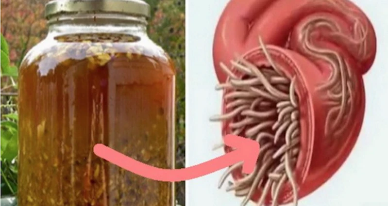 Poznaj przepis na naturalny i skuteczny antybiotyk. Wzmacnia odporność i zwalcza choroby