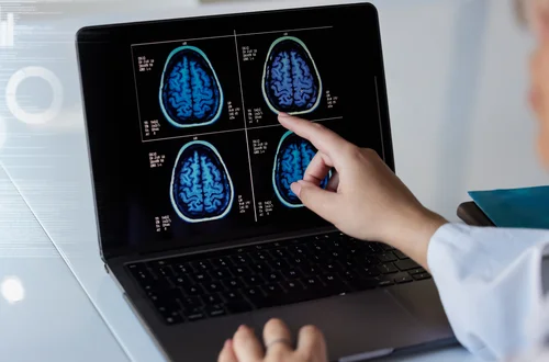 Światowy Dzień Mózgu: Jak Dbać o Zdrowie Naszego Najważniejszego Organ