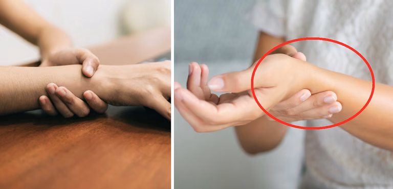 Masz takie znamię na ręce? Nie jesteś jedyna! Już wiadomo, co ono oznacza