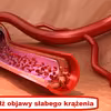 Te oznaki mogą świadczyć o ZŁYM KRĄŻENIU
