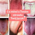 Co mówi o Twoim zdrowiu Twój język?