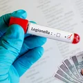 Legionella w czterech województwach! Kto dostanie odszkodowanie?