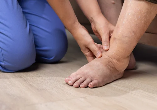 To nie sól zatrzymuje najwięcej wody w organizmie! Ten składnik jest znacznie gorszy