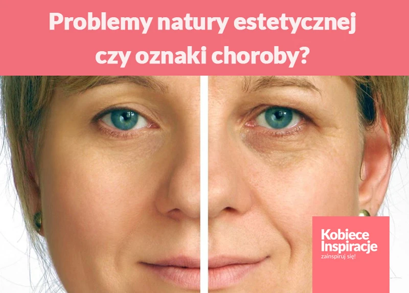 Problemy natury estetycznej, czy oznaki choroby?