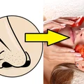 Wągry – pozbądź się ich za pomocą domowych peelingów!