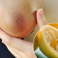 Cytryna na łokcie i kolana – ten szybki trik rozjaśni ciemną skórę w kilka dni