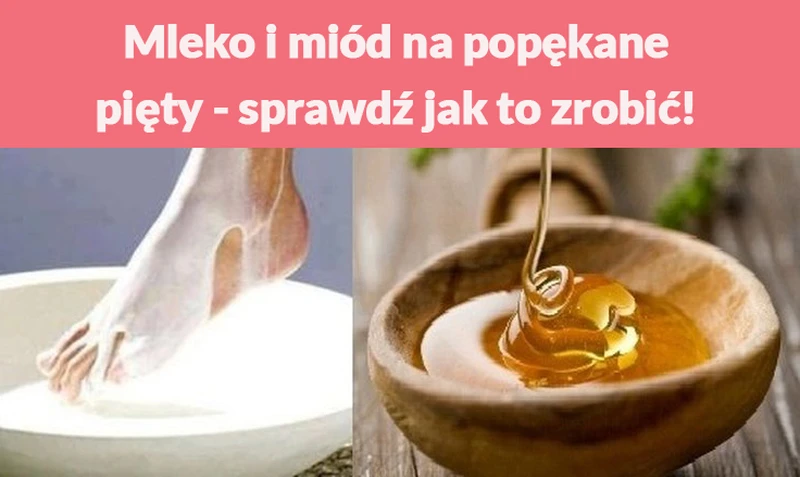 Mleko i miód na popękane pięty - sprawdź jak to zrobić!