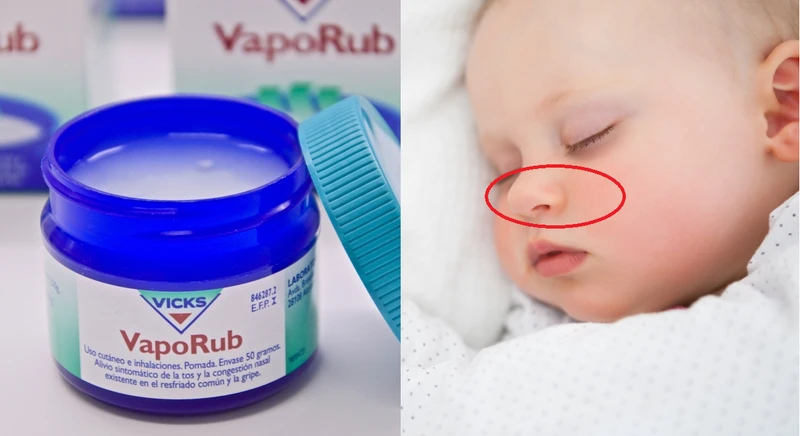 Maść Vicks VapoRub – nigdy nie stosuj jej u małych dzieci!