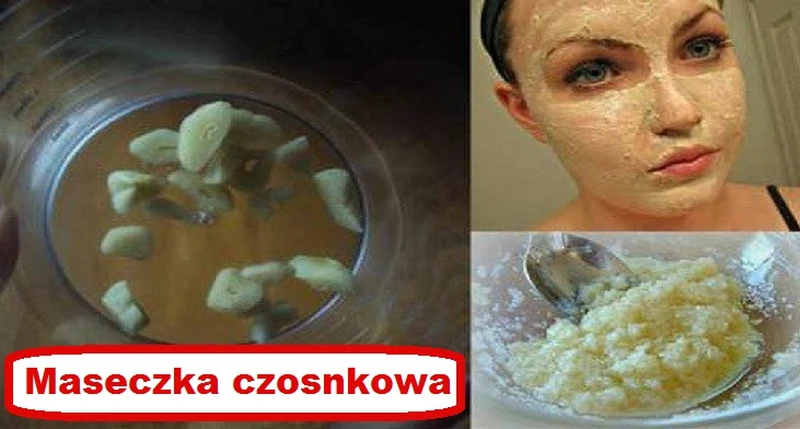 Wypróbuj CZOSNKOWĄ maseczkę która odmłodzi Twoją TWARZ i SZYJĘ!