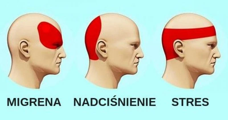 Pozbądź się BÓLU GŁOWY w 5 minut bez TABLETEK!