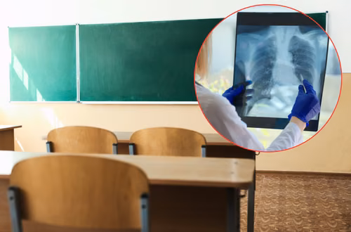 Potwierdzony przypadek gruźlicy w polskiej szkole! Setki dzieci i dorosłych zagrożonych - Sanepid rozpoczął procedury