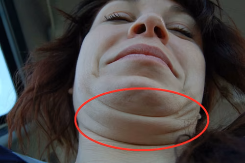 Dzięki temu w prosty sposób pozbędziesz się PODWÓJNEGO PODBRÓDKA!