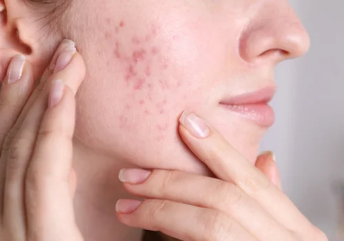 "Twoje ciało daje Ci sygnały!" – 7 oznak, że hormony wymykają się spod kontroli