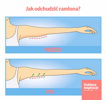 Jak odchudzić ramiona? - zobacz WIDEO z ćwiczeniami