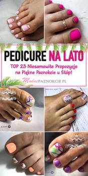 Modny Pedicure na Lato – TOP 23 Niesamowite Propozycje na Piękne Paznokcie u Stóp!