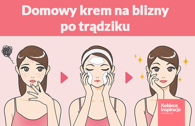 Domowy krem na blizny po trądziku i nie tylko
