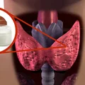 Olej kokosowy poprawia funkcję tarczycy! Dowiedz się, jak