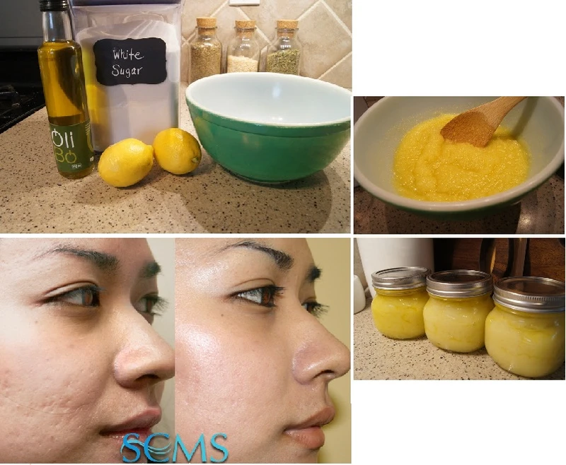 Domowy peeling