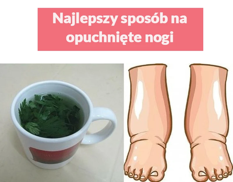 Najlepszy sposób na opuchnięte nogi!