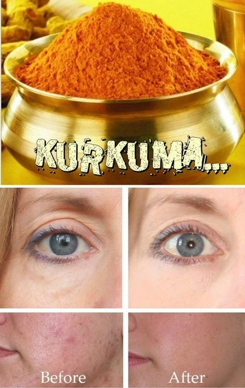 Świetne działanie kurkumy