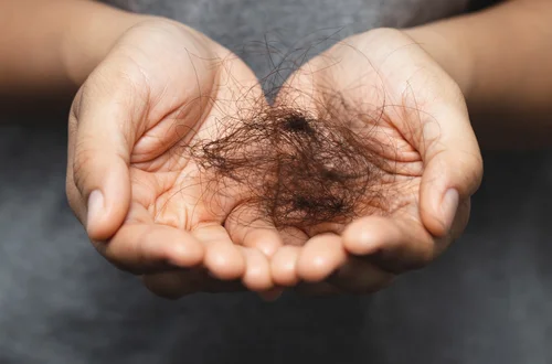 To nie stres powoduje wypadanie włosów najbardziej! Uwaga na ten składnik diety