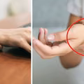 Masz takie znamię na ręce? Nie jesteś jedyna! Już wiadomo, co ono oznacza