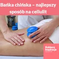 Bańka chińska – najlepszy sposób na cellulit