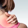 Nowym objawem koronawirusa mogą być zmiany skórne? Francuscy dermatolodzy ostrzegają!