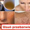 Sprawdź najlepsze domowe MASECZKI na PRZEBARWIENIA